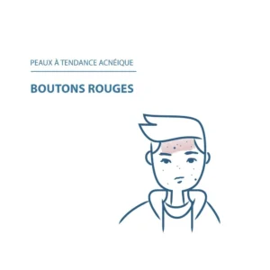 Ducray Crème Anti-imperfections KERACNYL PP+ – Image 4